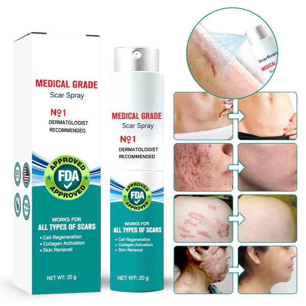 Seurico™ Scar Spray - For Acne Scars, Surgical Scars and Stretch Marks